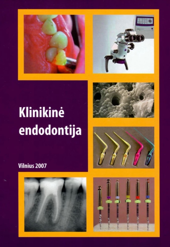 Klinikinė endodontija
