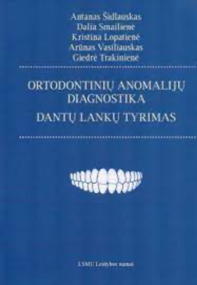 Ortodontinių anomalijų diagnostika. Dantų lankų tyrimas