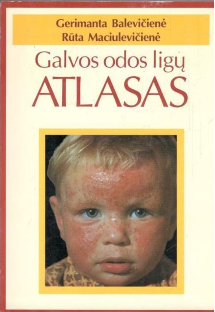 Galvos odos ligų atlasas
